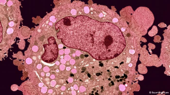Как выглядят клетки рака под микроскопом, размножение раковых клеток