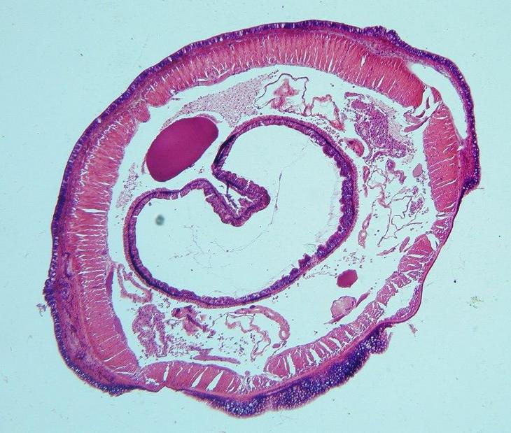 Дождевой червь под микроскопом