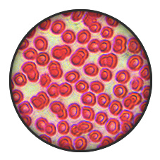 Эритроциты в крови под микроскопом