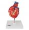 Классическая модель сердца с шунтом, 2 части