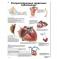Медицинский плакат Распространенные сердечные заболевания