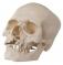 Модель черепа человека с «волчьей пастью» и с расщелиной в нижней челюсти