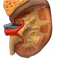 Модель почки, нефрона и клубочка UL