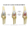 Модель коленного сустава собаки при остеоартрите,  4-этапная демонстрационная модель UL