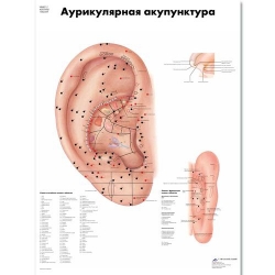 Медицинский плакат Акупунктура уха