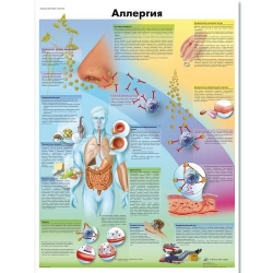 Медицинский плакат Аллергия