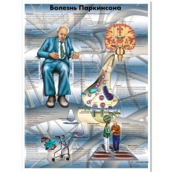 Медицинский плакат Болезнь Паркинсона