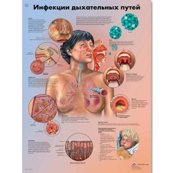 Медицинский плакат Инфекции дыхательных путей