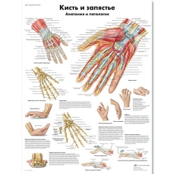 Медицинский плакат Кисть и запястье, анатомия и патология
