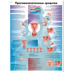Медицинский плакат Противозачаточные меры