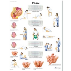 Медицинский плакат Роды