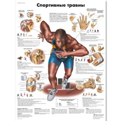 Медицинский плакат Спортивные травмы