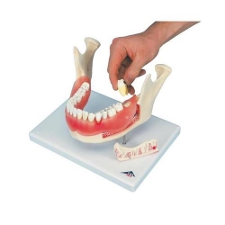Модель болезней зубов
