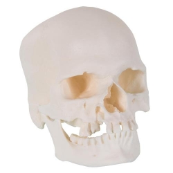 Модель черепа человека, микроцефал