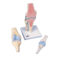 Модель коленного сустава в разрезе