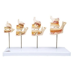 Модель развития зубов