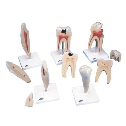 Серия классических моделей зуба