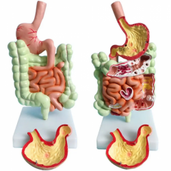 Патологическая модель толстой кишки желудочно-кишечного тракта анатомическая модель толстой кишки UL-V55