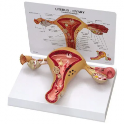 Модель женской половой анатомии матки UL-XV34