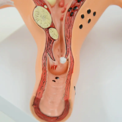 Модель женской половой анатомии матки UL-XV34