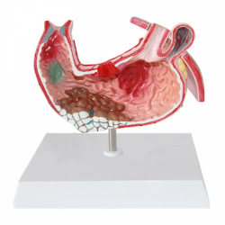 Анатомическая модель желудка  UL-V53