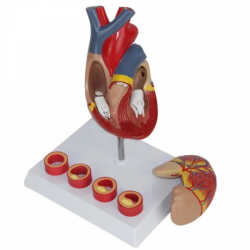 Естественная модель большой анатомии сердца взрослого человека с 4 стадиями тромбоза UL-XV25
