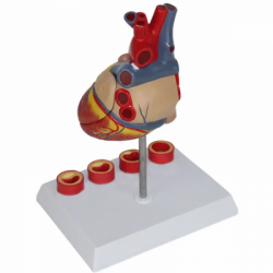 Естественная модель большой анатомии сердца взрослого человека с 4 стадиями тромбоза UL-XV25