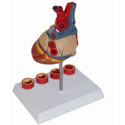 Модель сердца взрослого человека с 4 стадиями тромбоза UL