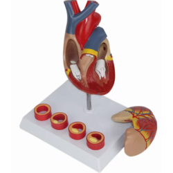 Модель сердца взрослого человека с 4 стадиями тромбоза UL