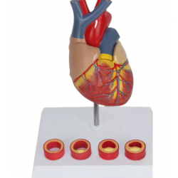 Модель сердца взрослого человека с 4 стадиями тромбоза UL