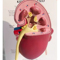 Модель почки человека с патологиями UL