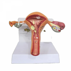 Модель женской матки и яичников UL-03008