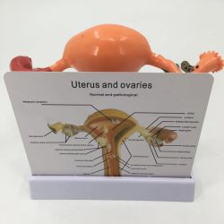 Модель заболеваний матки и яичников UL-03005