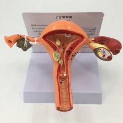 Модель заболеваний матки и яичников UL-03005