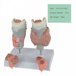 Модель патологии щитовидной железы UL-V16
