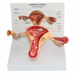Женская модель человеческого яичника UL-01