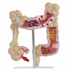 Патологическая модель толстой кишки человека UL