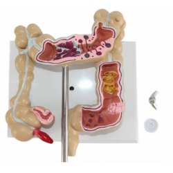 Патологическая модель толстой кишки человека UL