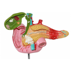 Патологическая модель двенадцатиперстной кишки, желчного пузыря, селезенки и поджелудочной железы UL