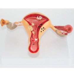 Анатомическая матка человека модель патологических изменений репродуктивного отдела UL-03036