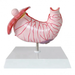 Анатомическая модель больного желудка человека   UL-326-1