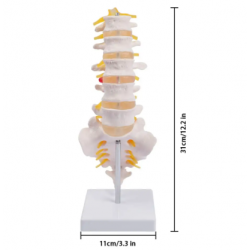 Модель поясничных позвонков в натуральную величину с крестцом, копчиком и грыжей диска UL