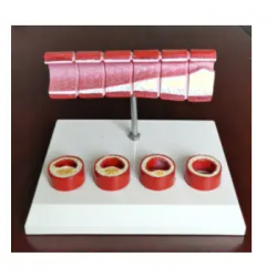 Атериосклероз и тромбоз Модель патологии кровеносной системы UL-326-5