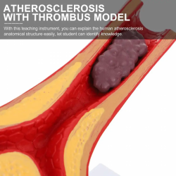 Модель атеросклероза и тромбоза артерий человека Висцеральная анатомическая модель UL-326-1