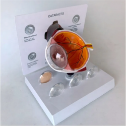 Модель заболевания роговицы глаза с состоянием роговицы UL-IN